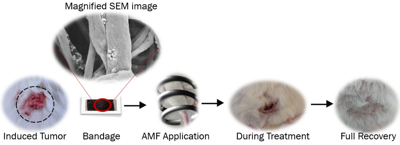 magnetic nanofibres bandage