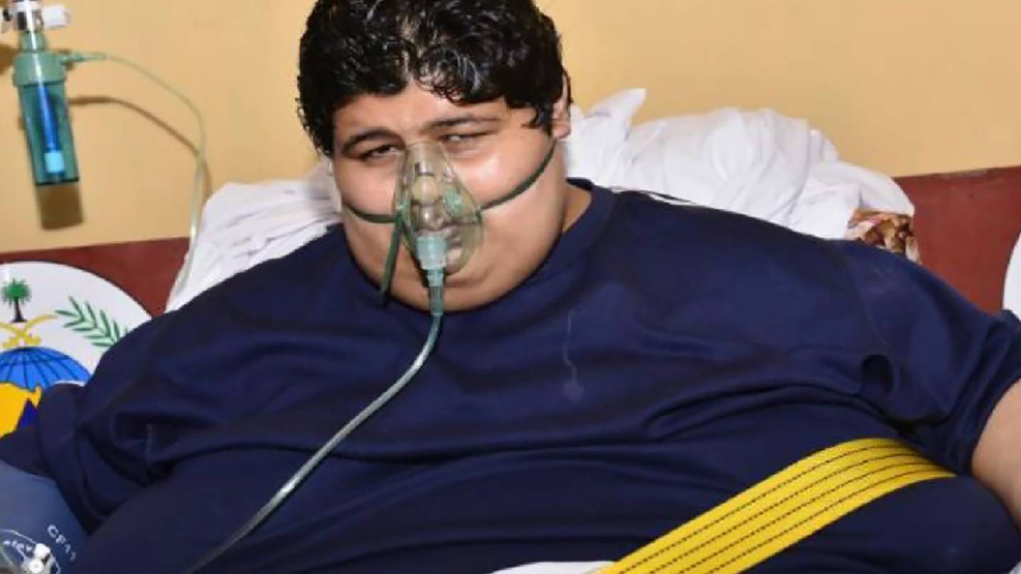 Weight loss by World heaviest teen, Khaled Mohsen Al Shaeri weight loss, Weight loss by Saudi Arabian teen, Khaled Mohsen Al Shaeri weight, Khaled Mohsen Al Shaeri news, ತೂಕ ಇಳಿಸಿದ ವಿಶ್ವದ ಅತ್ಯಂತ ಭಾರವಾದ ಯುವಕ, ಖಲೀದ್ ಮೊಹ್ಸೆನ್ ಅಲ್ ಶೇರಿ ತೂಕ ಇಳಿಕೆ, ತೂಕ ಇಳಿಸಿಕೊಂಡ ಸೌದಿ ಅರೇಬಿಯನ್​ ಯುವಕ, ಖಲೀದ್ ಮೊಹ್ಸೆನ್ ಅಲ್ ಶೇರಿ ತೂಕ, ಖಲೀದ್ ಮೊಹ್ಸೆನ್ ಅಲ್ ಶೇರಿ ಸುದ್ದಿ,