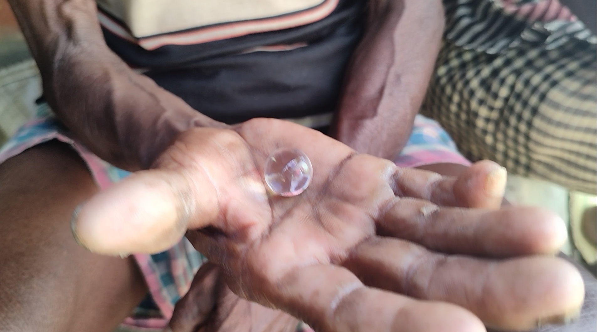 patients-who-went-for-cataract-operation-remove-eye-in-ghatshila