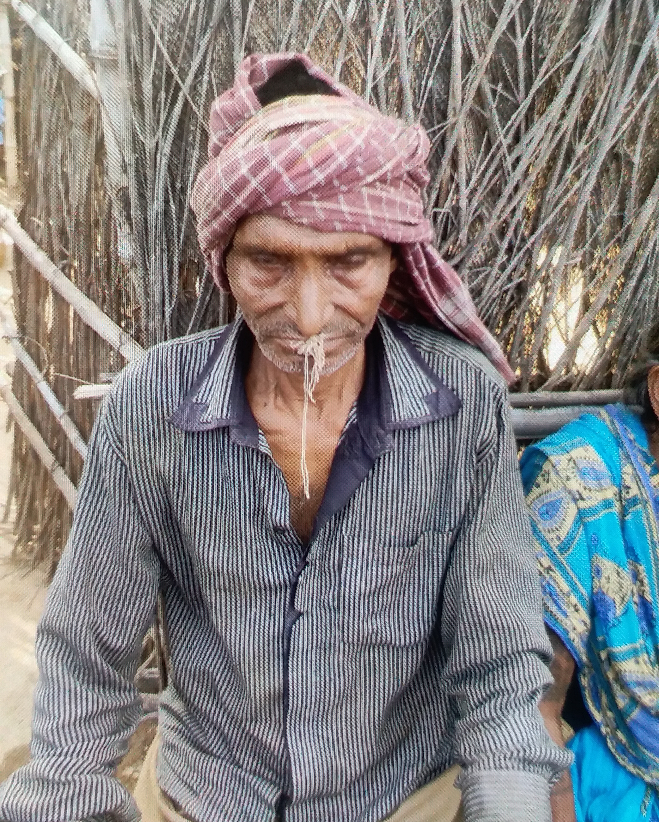 one person mouth sewing incident in Palamu