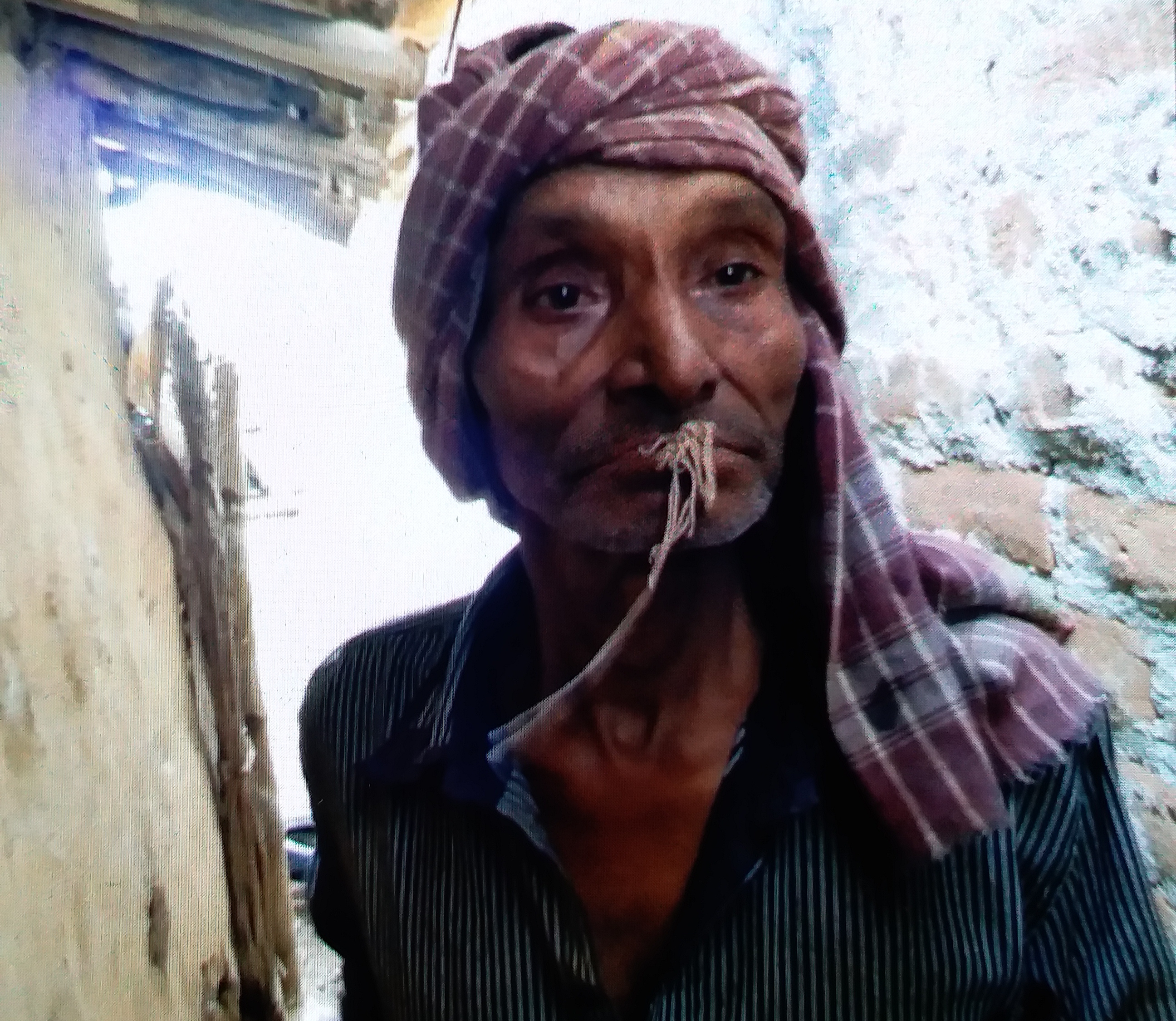 Man's mouth sewn in Palamu