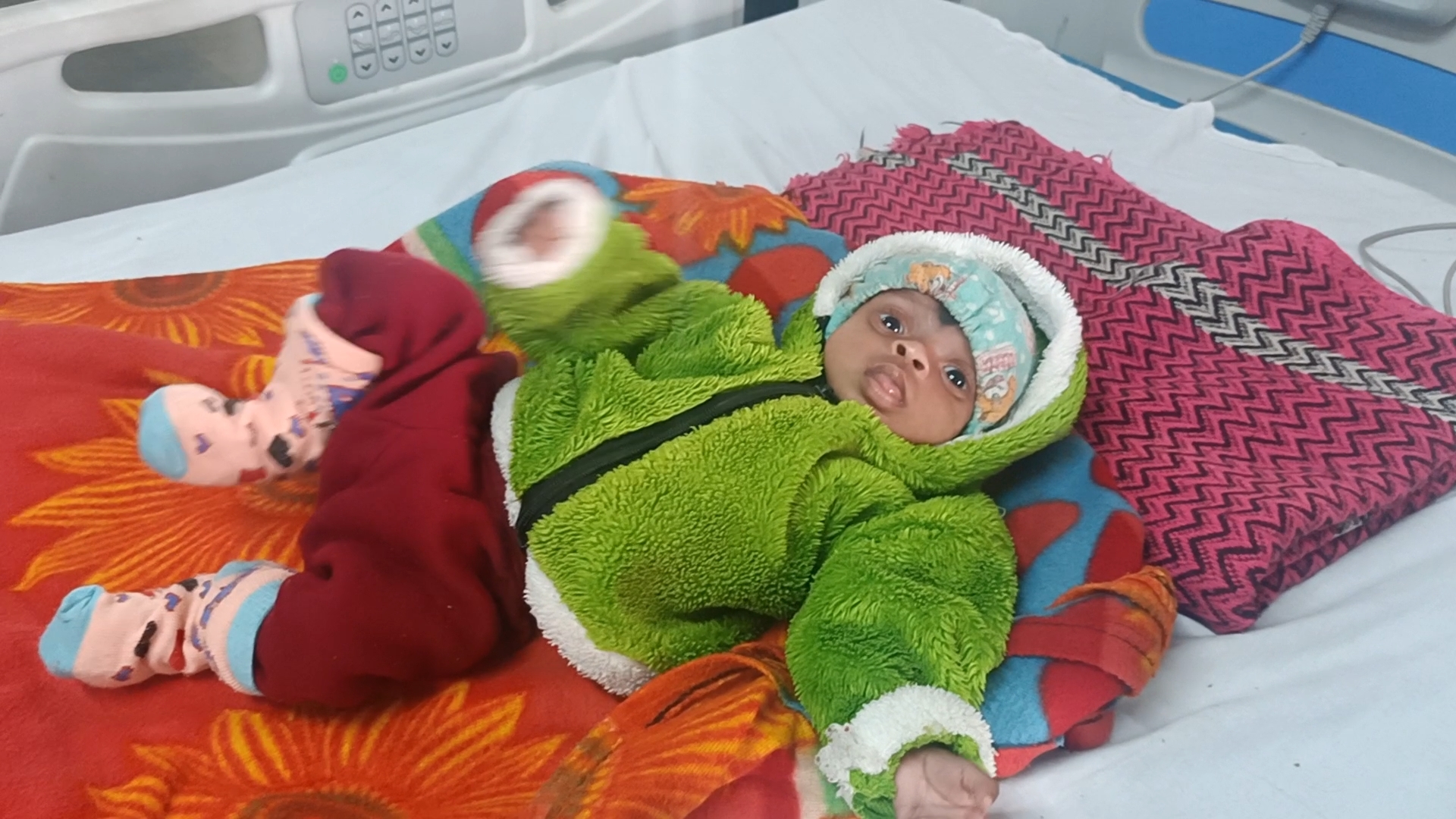 RIMS doctors saved life of four month old child by treating