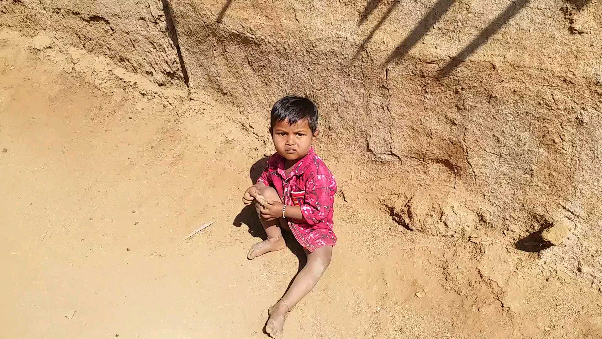 Malnutrition in Melghat