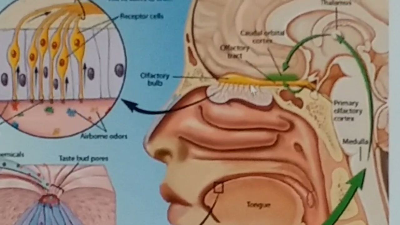 Post Covid Parosmia