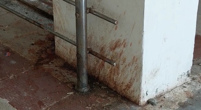 Chhindwara District Hospital Dirty