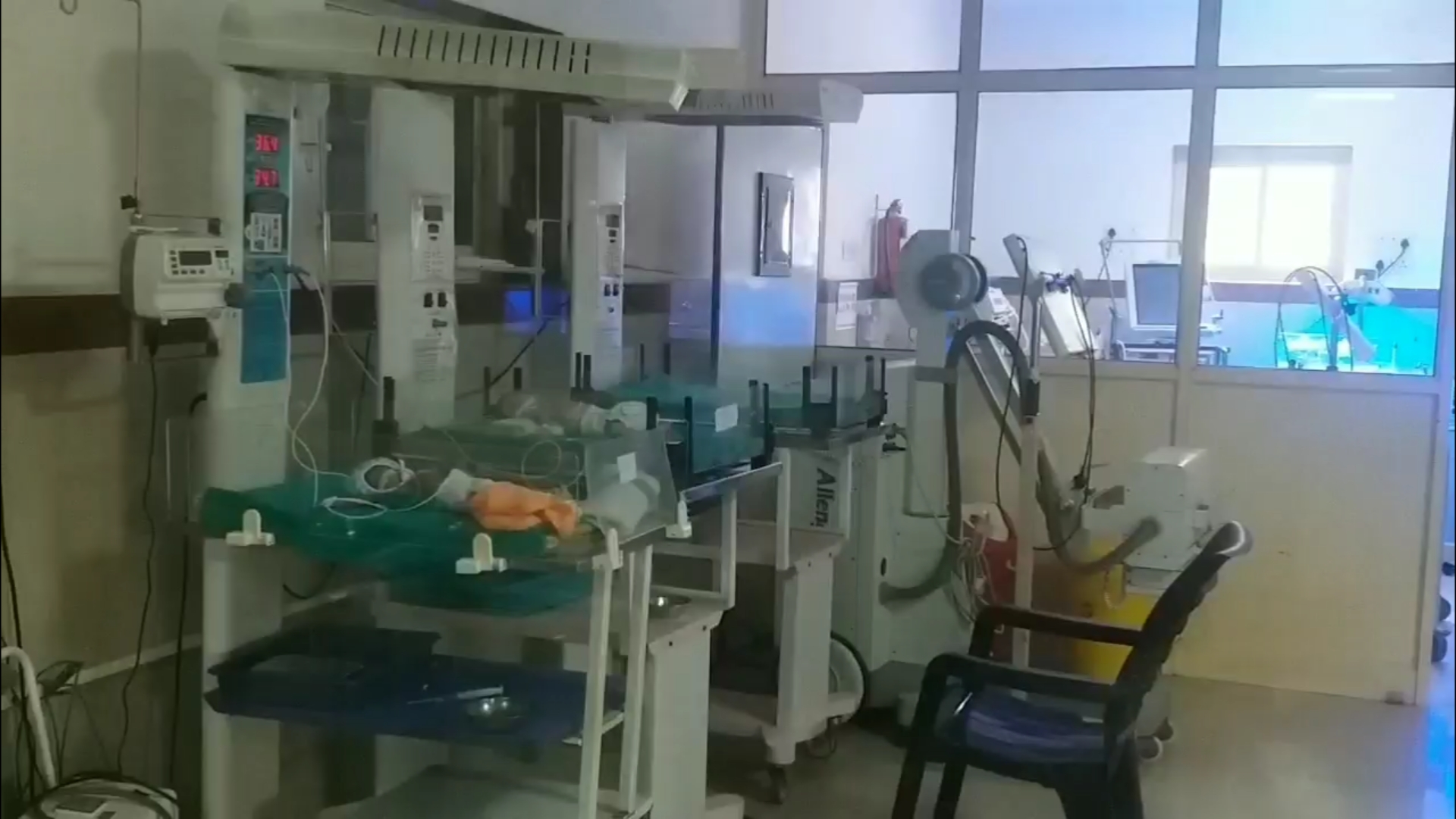 Newborn on ventilator