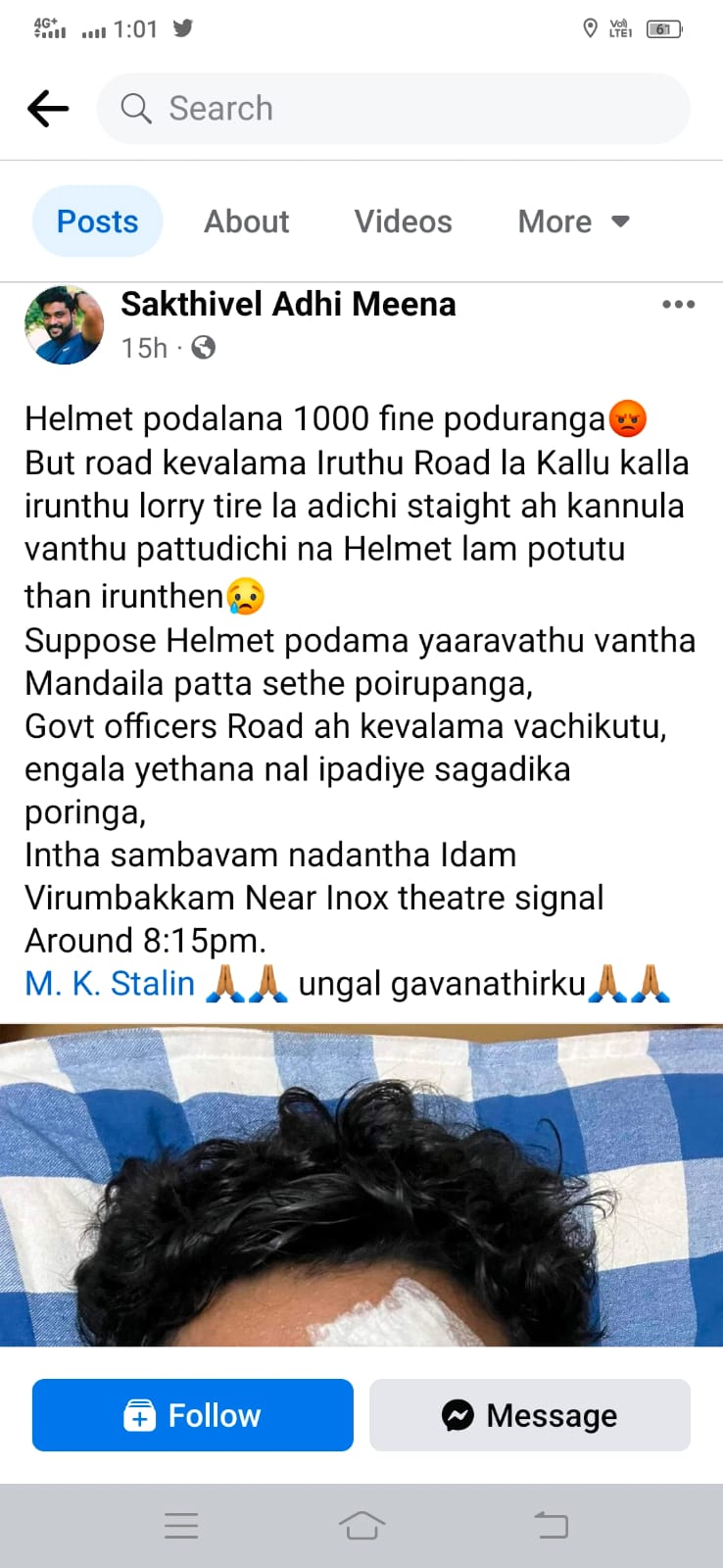 சாலையில் கிடந்த கல் கண்ணில் பட்டதில் பிரபல காமெடி நடிகர் படுகாயம்!!