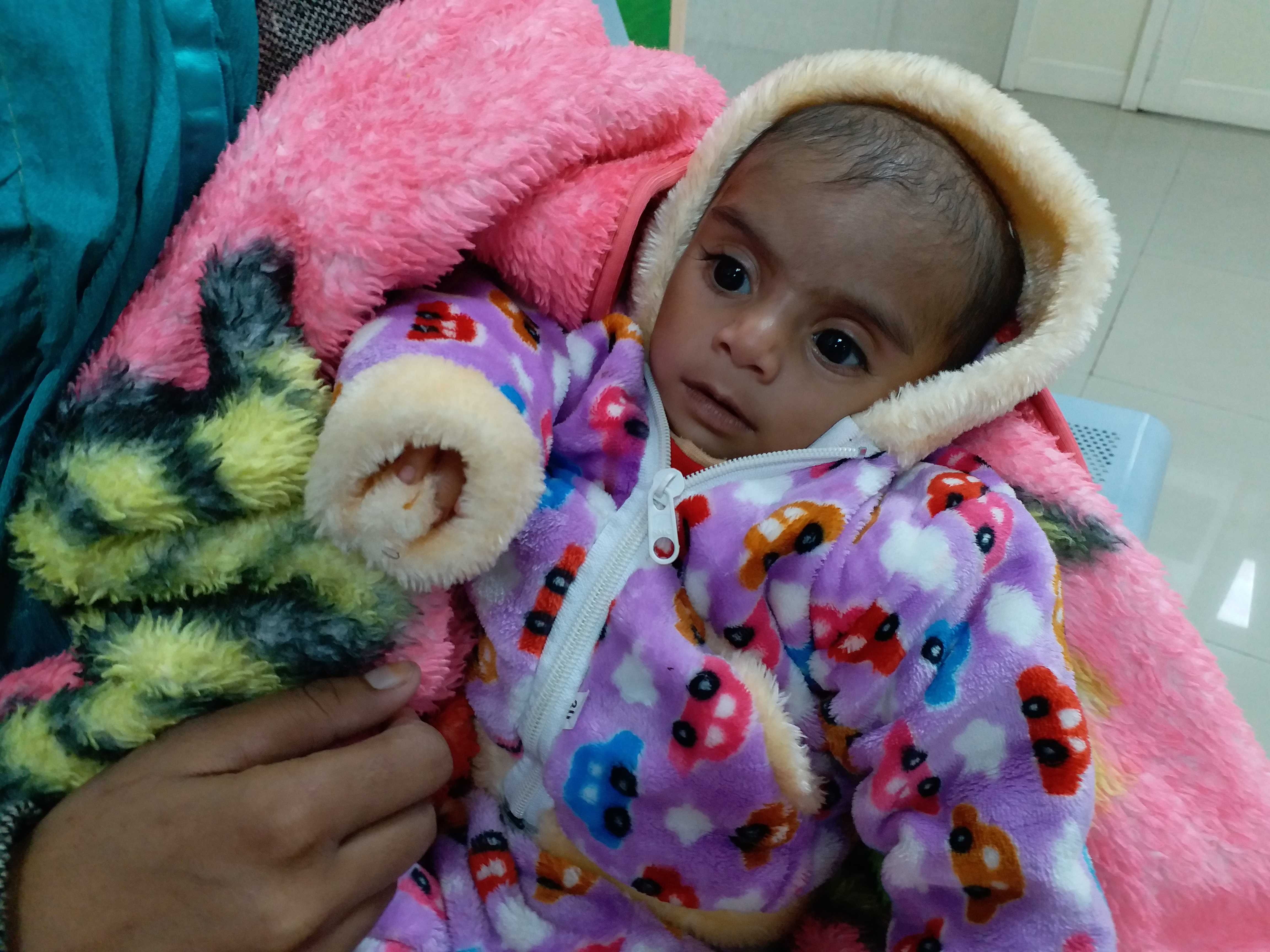 AMU: Extraordinary surgery gave the baby new life