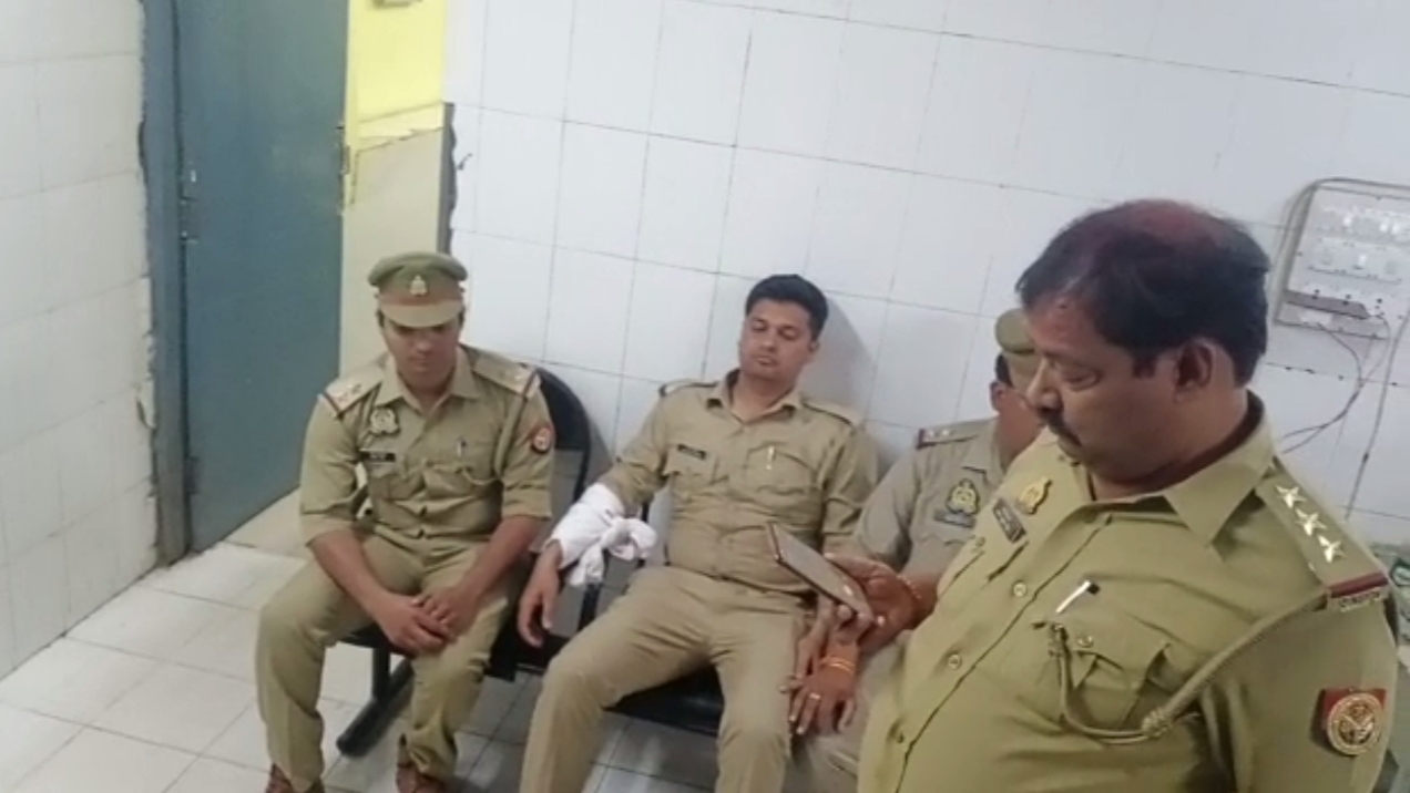 मुठभेड़ में घायल पुलिसकर्मी