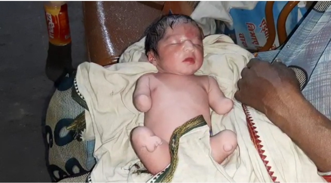 महिला ने बिना हाथ और पैर वाले बच्चे को जन्म दिया.