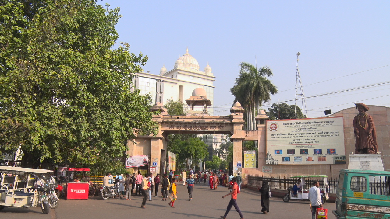 विकृत अंगों और जन्मजात विसंगतियों को संवार रहा लखनऊ का केजीएमयू