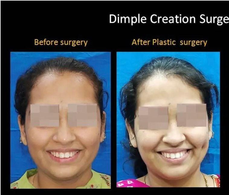 Plastic surgery in Prayagraj SRN Hospital . Cosmetic Surgery in SRN Hospital Prayagraj .