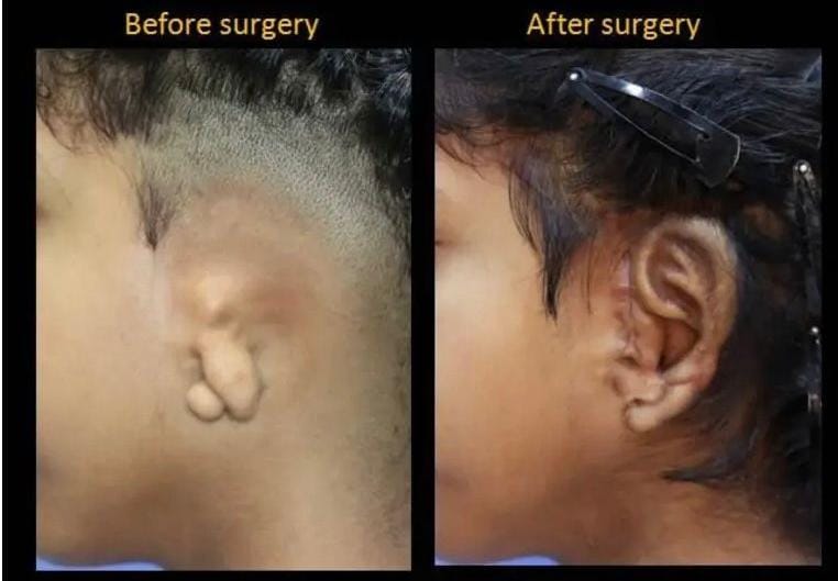 Plastic surgery in Prayagraj SRN Hospital . Cosmetic Surgery in SRN Hospital Prayagraj .