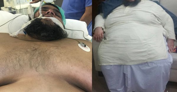 Pakistan army breaks wall to airlift man weighing 330Kg