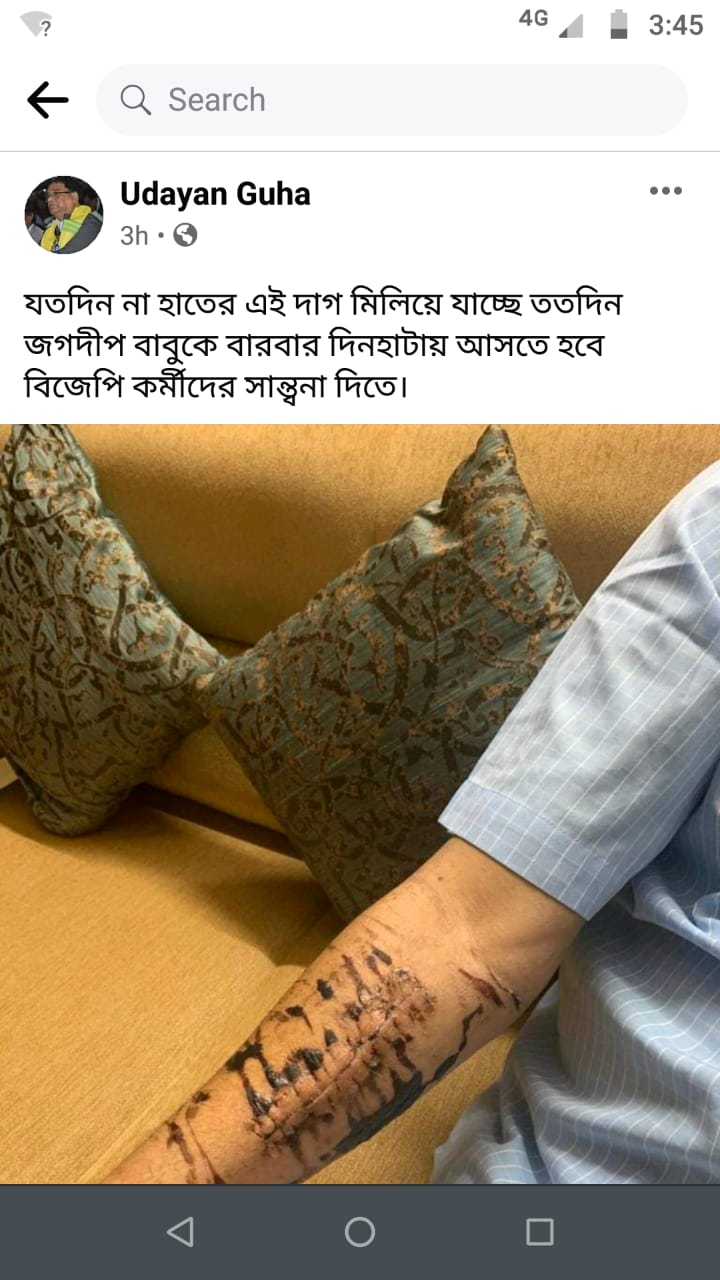 ex mla of dinhata Udayan Guha warns BJP with pictures of broken hands on social media in coochbehar