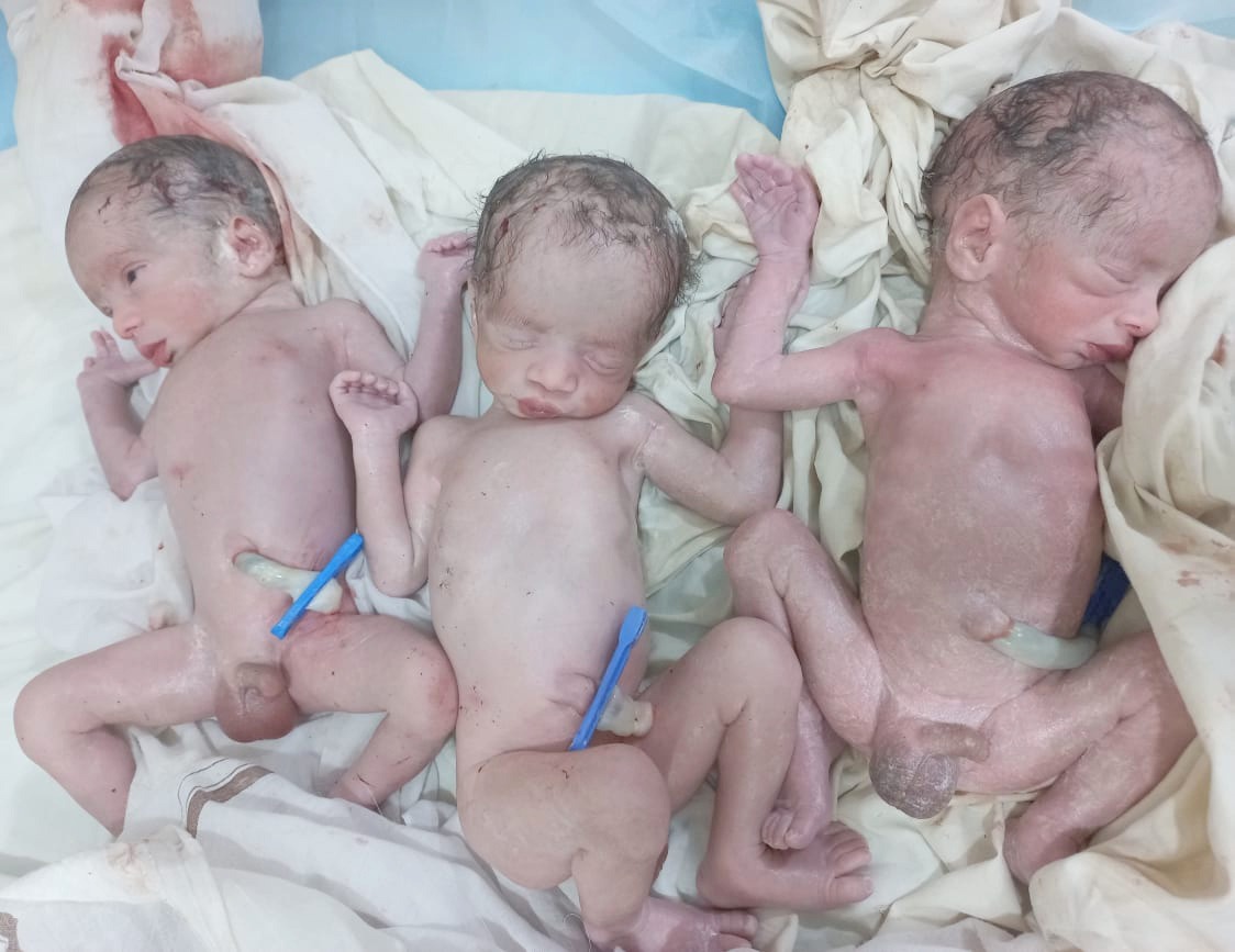 triple male children born in yadgiri